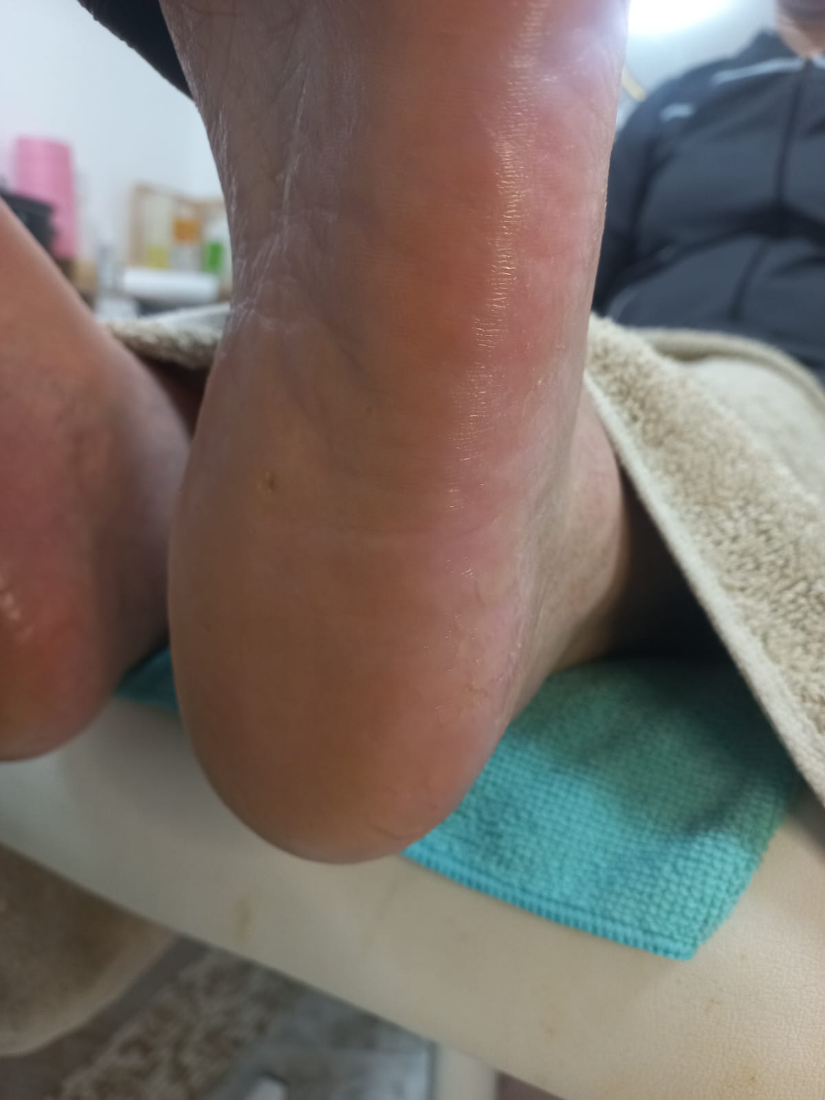 بعد — ترطيب وتنعيم الكعب