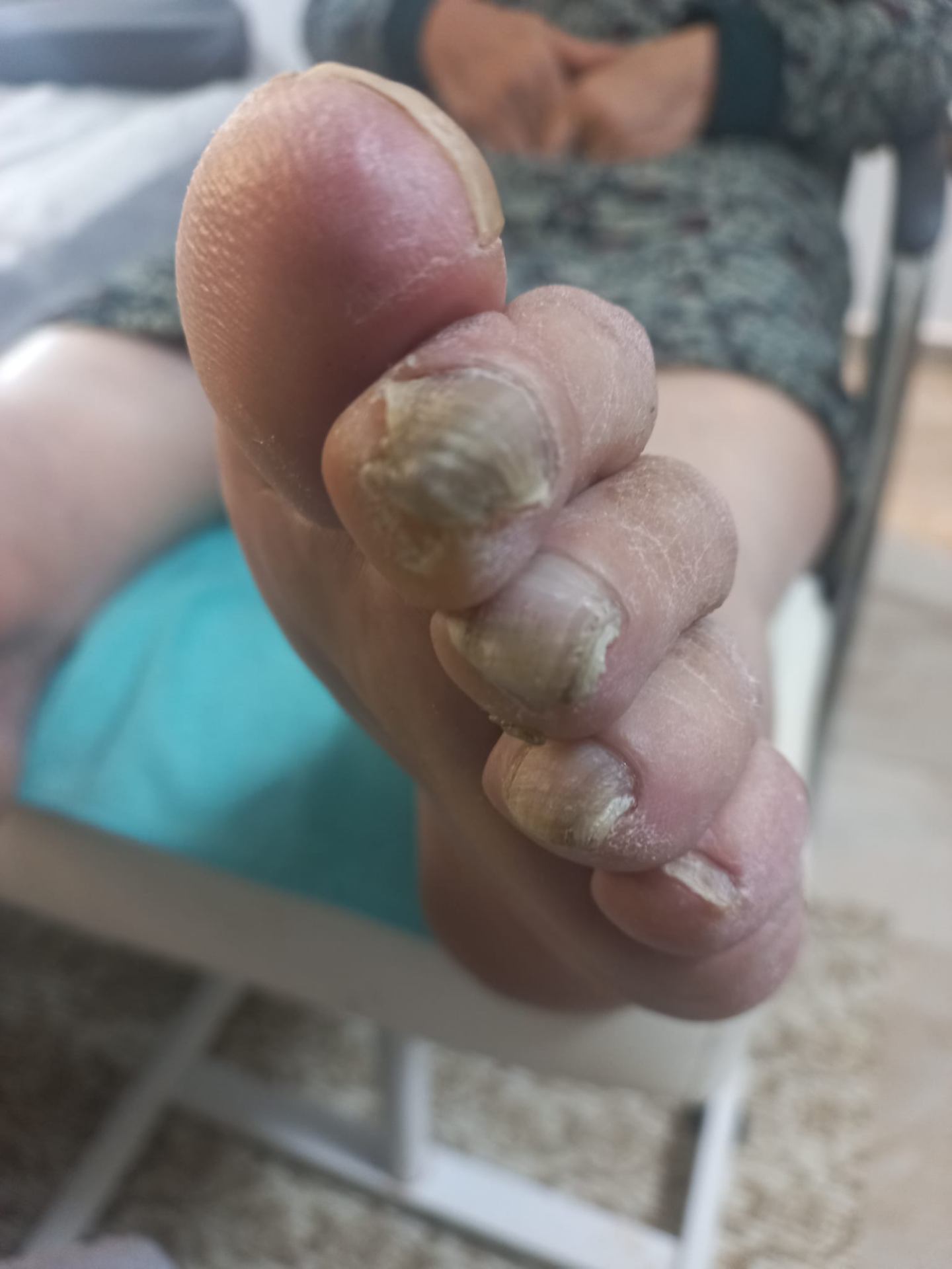 قبل — العناية بالأظافر والقدمين